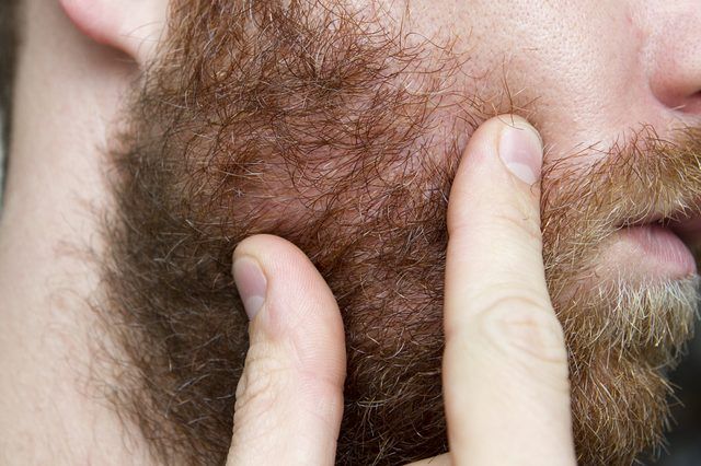 Coiffez votre barbe d'une manière qui élimine les taches chauves.